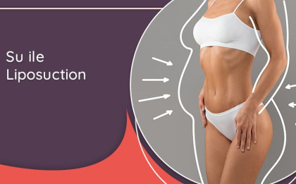 estetik,PLASTİK VE REKONSTRÜKTİF CERRAHİ UZMANI,el cerrahisi,izmir,su,liposuction,liposakşın,bölgesel incelme